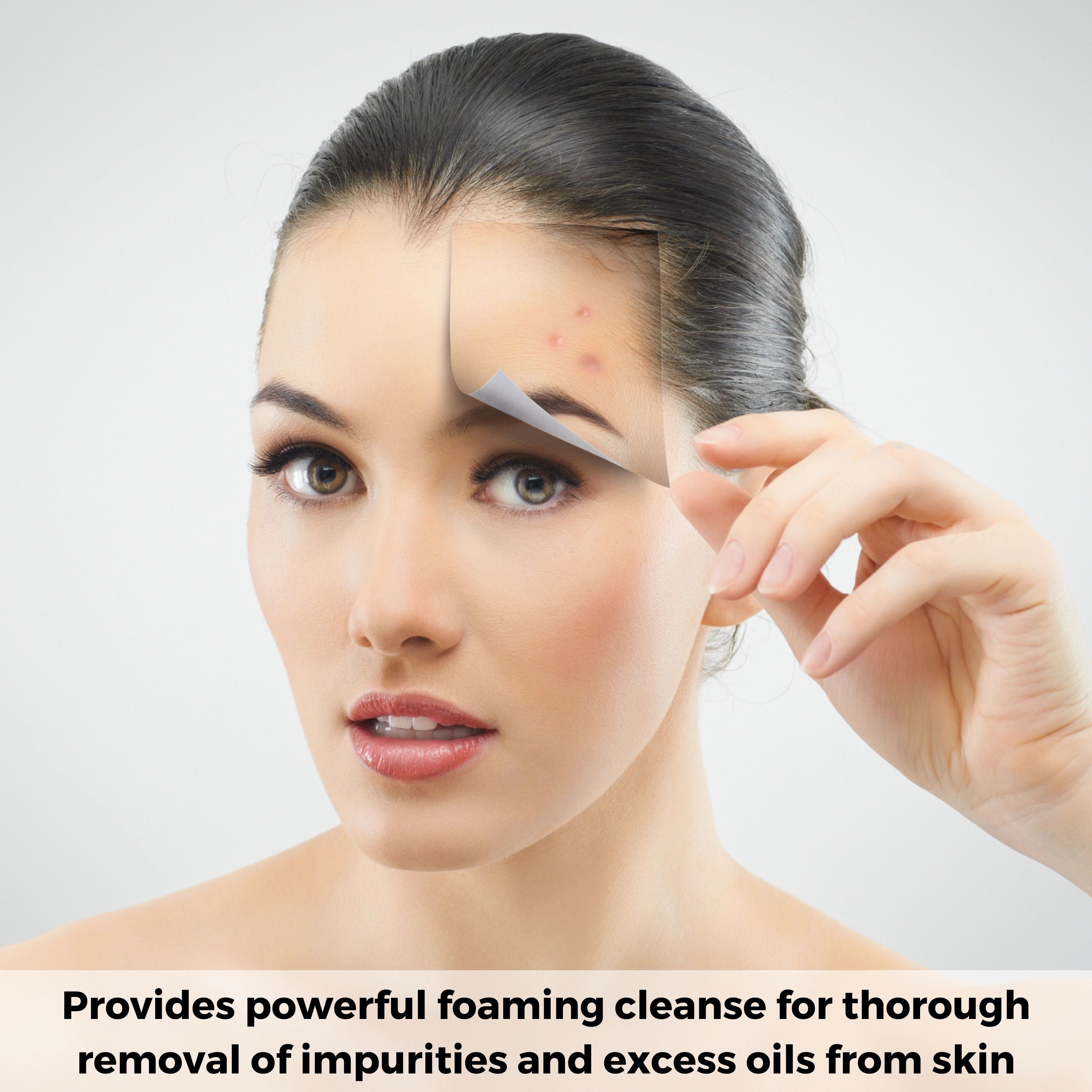 Extra Strength Acne Wash – Powerful foaming cleanser designed to treat and prevent acne
