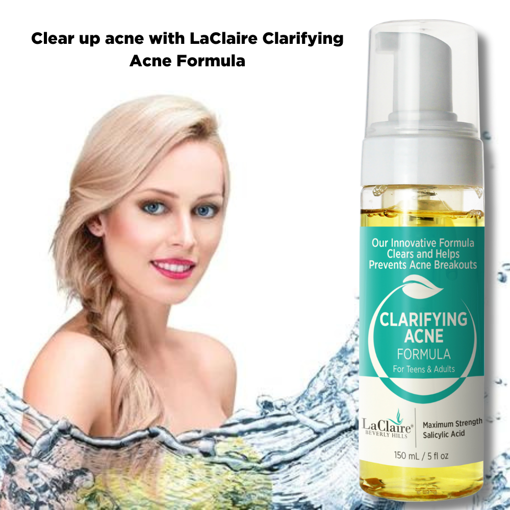 Extra Strength Acne Foaming Cleanser – 50mL bottle for deep cleansing and acne treatment.